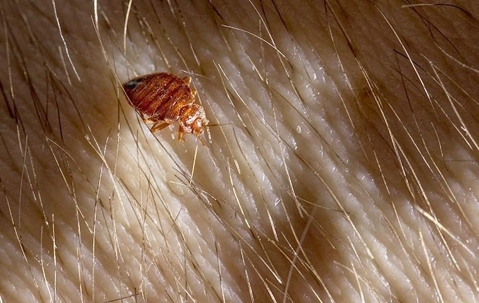 A bed bug on skin